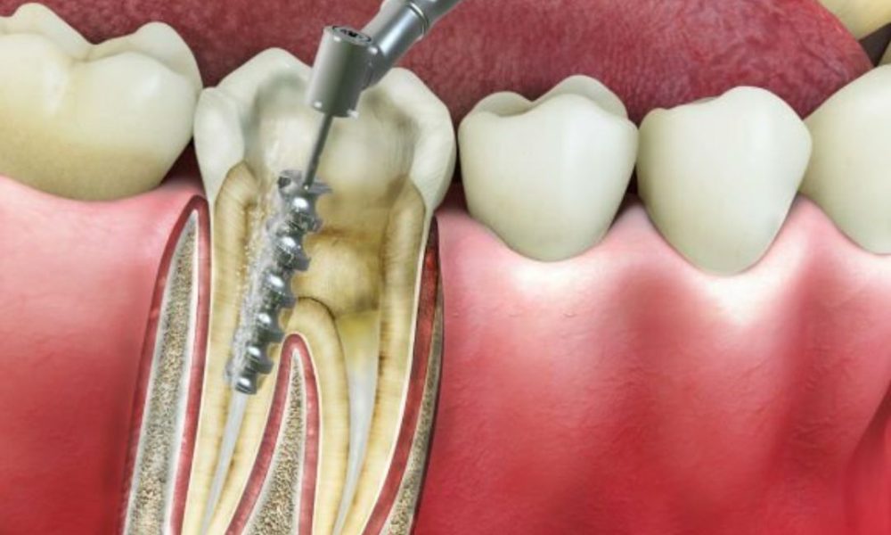 restorative dentistry